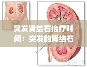 突发肾结石治疗时间：突发的肾结石是什么原因? 