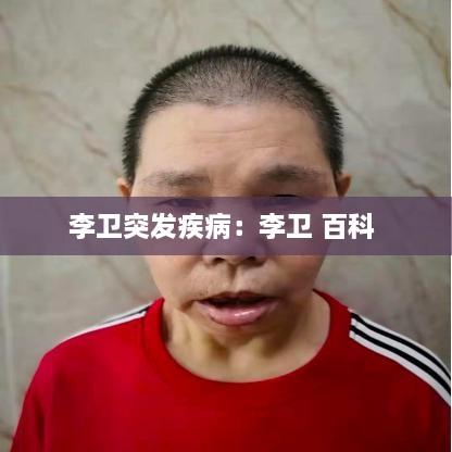 李卫突发疾病：李卫 百科 