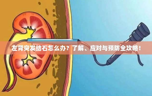 左肾突发结石怎么办？了解、应对与预防全攻略！