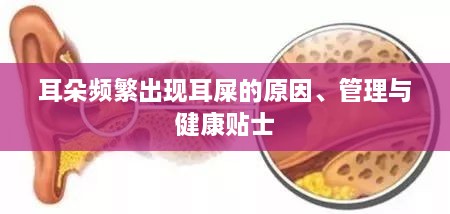 耳朵频繁出现耳屎的原因、管理与健康贴士