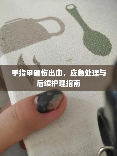 手指甲砸伤出血，应急处理与后续护理指南