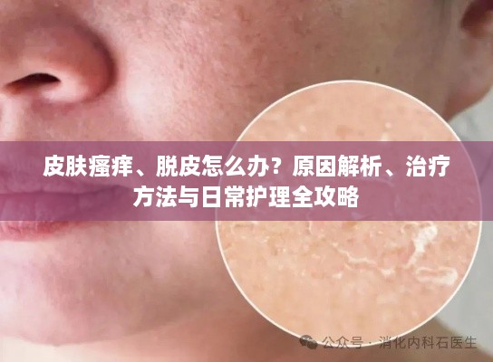皮肤瘙痒、脱皮怎么办？原因解析、治疗方法与日常护理全攻略